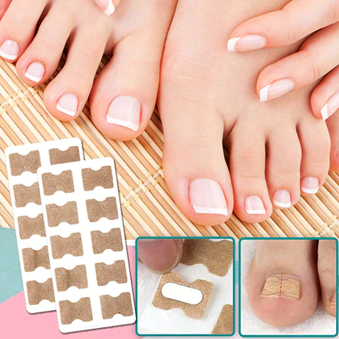 Zelfklevende Nagelcorrectiestrips voor Teennagels Verzorging met Natuurlijke Uitstraling voor Pedicure Thuis