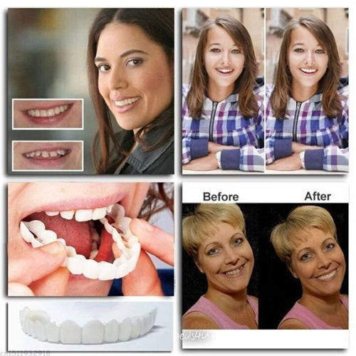 Cosmetische Tandveneers met Aanpasbare Pasvorm Herbruikbaar voor Natuurlijke Witte Glimlach Tandcorrectie