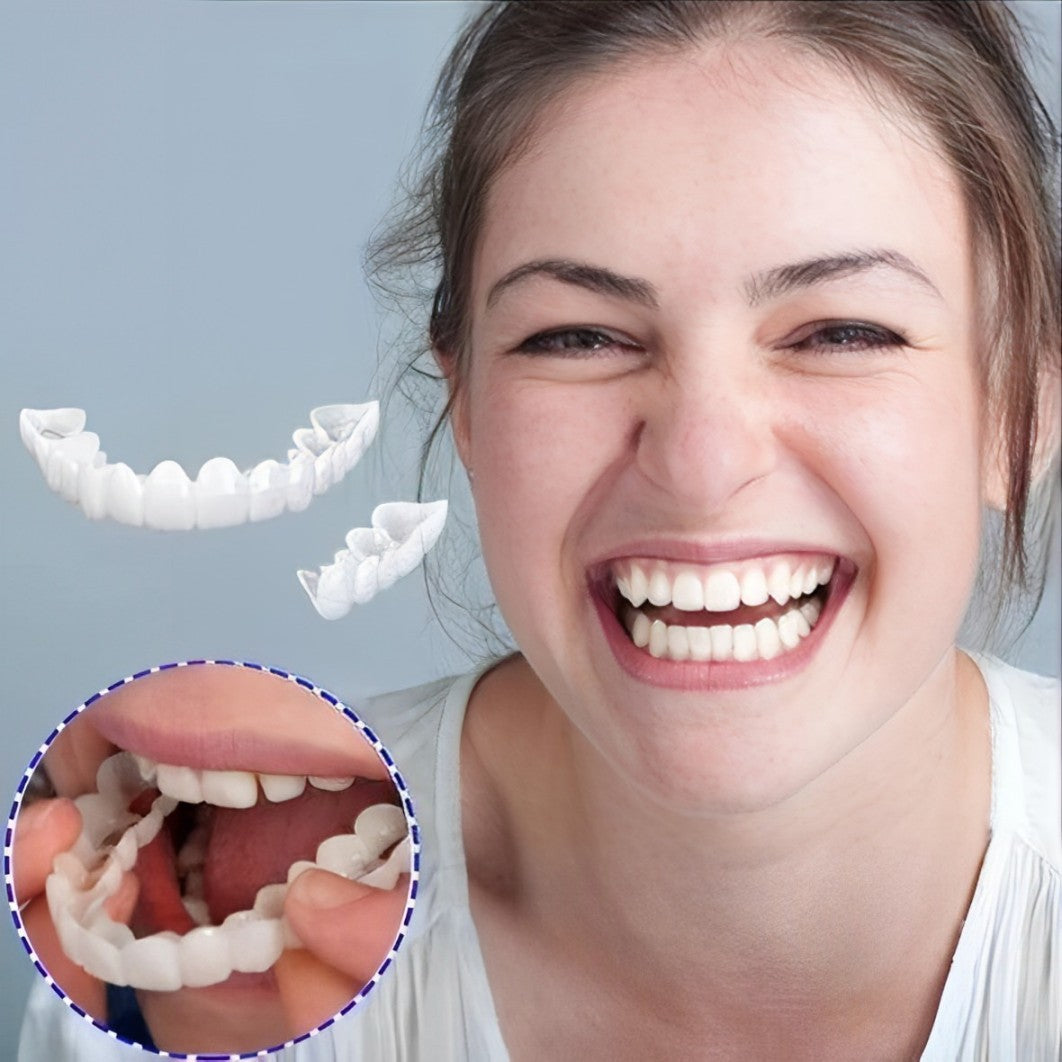 Cosmetische Tandenschalen Set Boven & Onder voor Stralende Glimlach Persoonlijke Tandverzorging Thuis