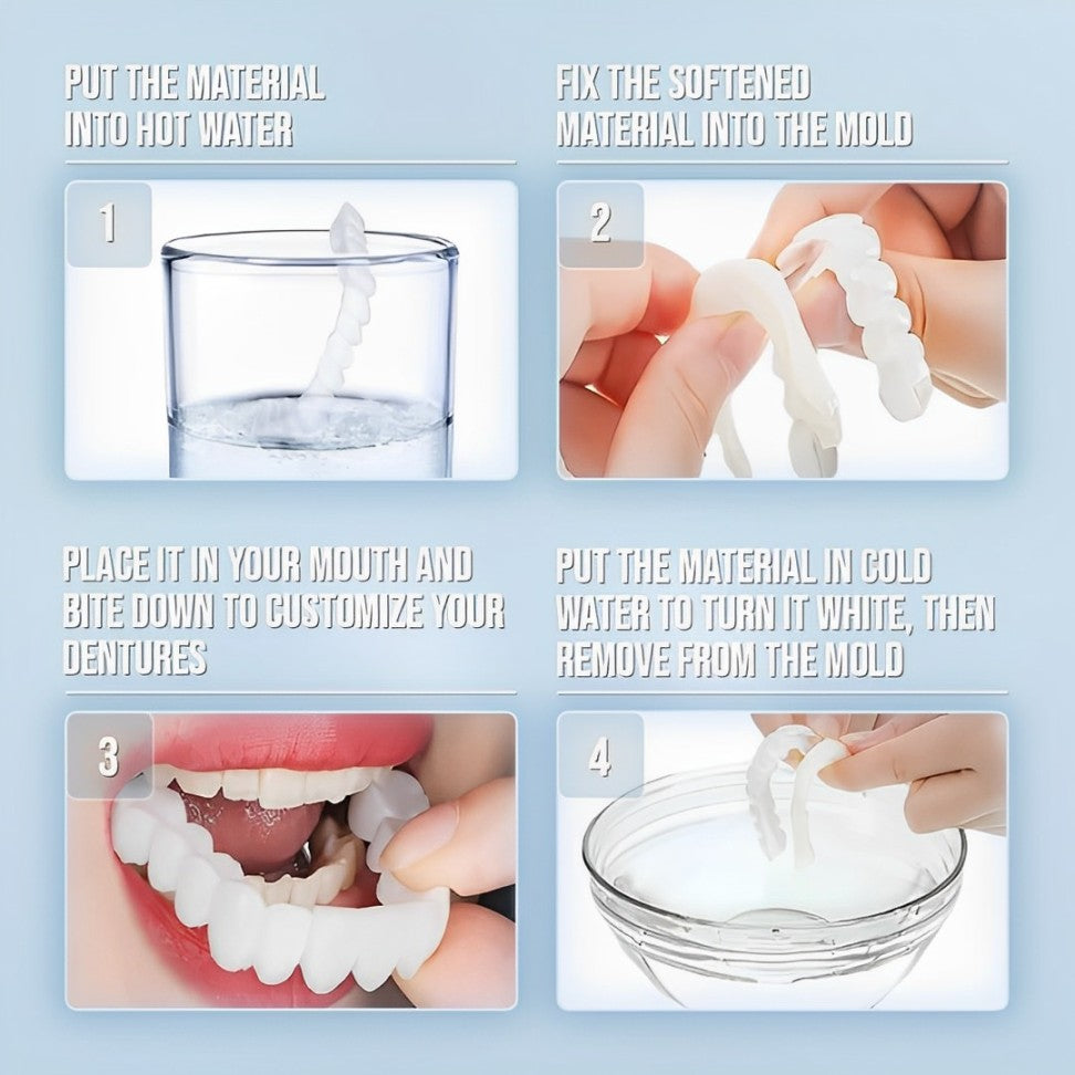 Cosmetische Tandenschalen Set Boven & Onder voor Stralende Glimlach Persoonlijke Tandverzorging Thuis