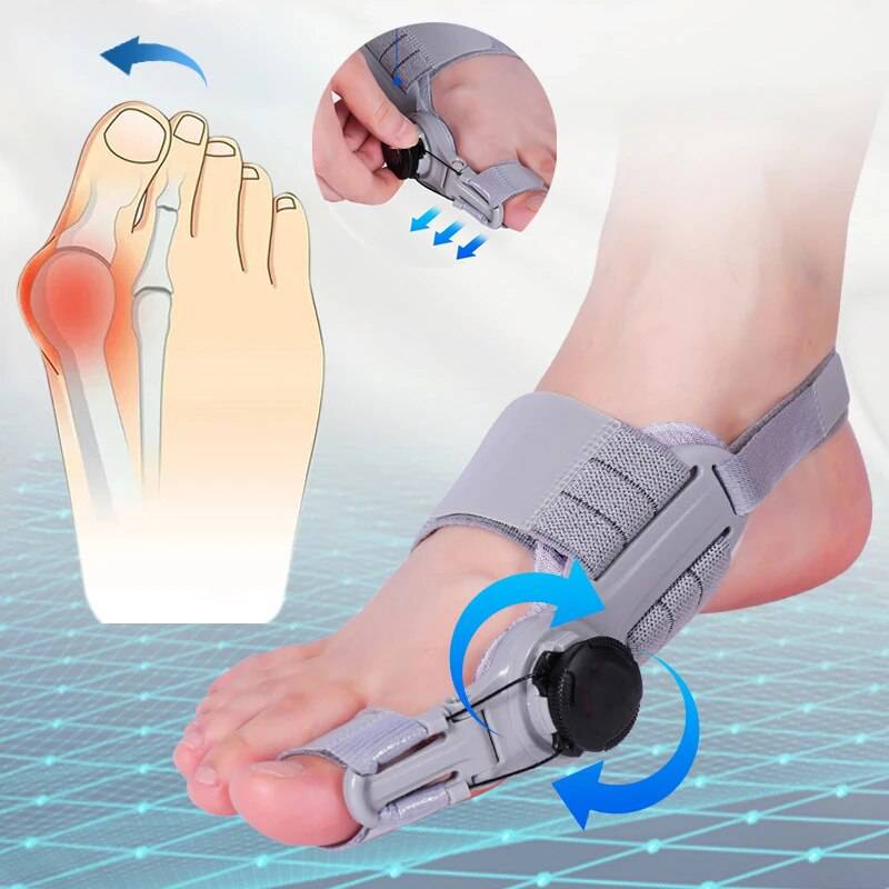 Teencorrector met Verstelbare Druk voor Hallux Valgus Behandeling Overdag en 's Nachts Comfortabel Orthopedisch