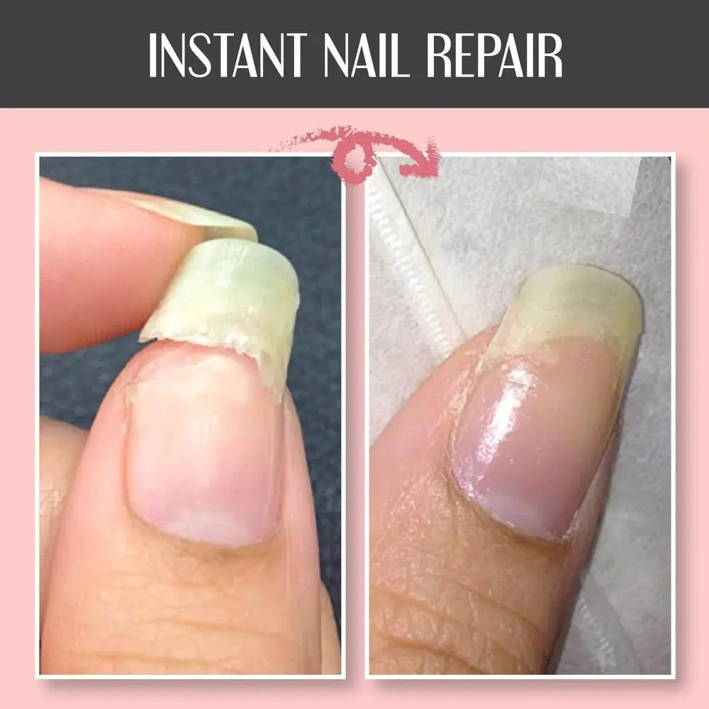 Nagelreparatie Beschermgel - Versterkende Verzorging voor Nagels 5g Transparant