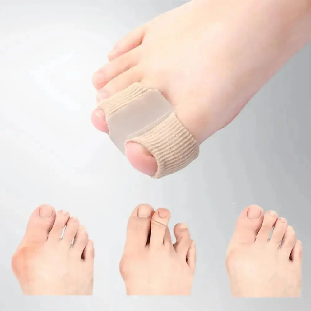 Teenspreiderset Siliconen voor Hallux Valgus en Overlappende Tenen - Zachte Correctie & Pijnverlichting