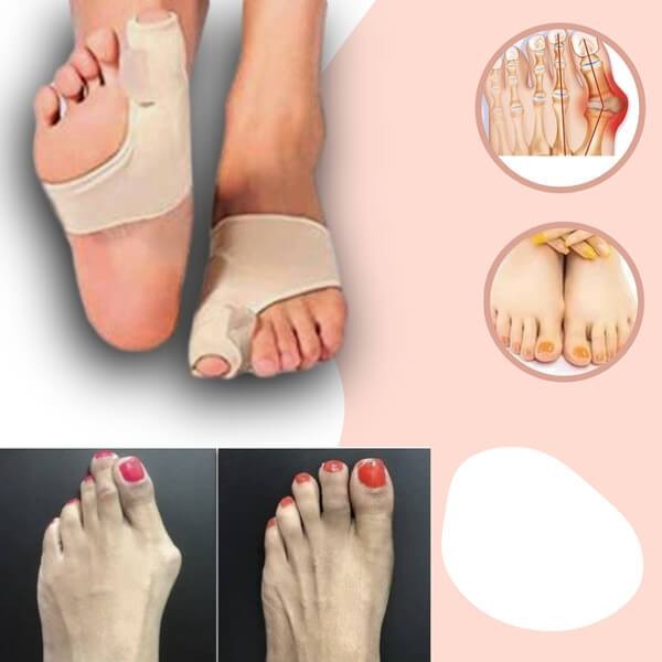 Hallux Valgus Corrector Teenspalk Bunion Pijnverlichting Gel Voetorthese Dag Nacht Teencorrectie Comfort
