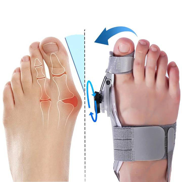 Teencorrector met Verstelbare Druk voor Hallux Valgus Behandeling Overdag en 's Nachts Comfortabel Orthopedisch