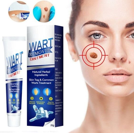 Huidverzorgende Gel tegen Wratten en Huiduitstulpingen 20ml met Plantaardig Extract voor Zachte Huid