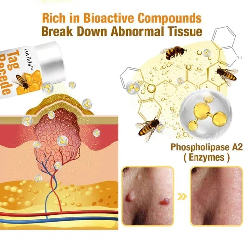 Bijengifsray voor Huidgroei - Natuurlijke Verwijdering van Huidlappen, Wratten en Moedervlekken