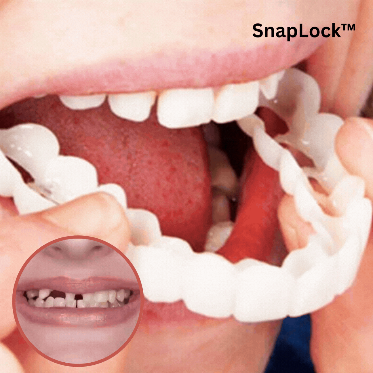 Cosmetische Snap-On Tandveneer Wit Flexibel Herbruikbaar DIY Tandcover Boventanden voor Mooie Glimlach