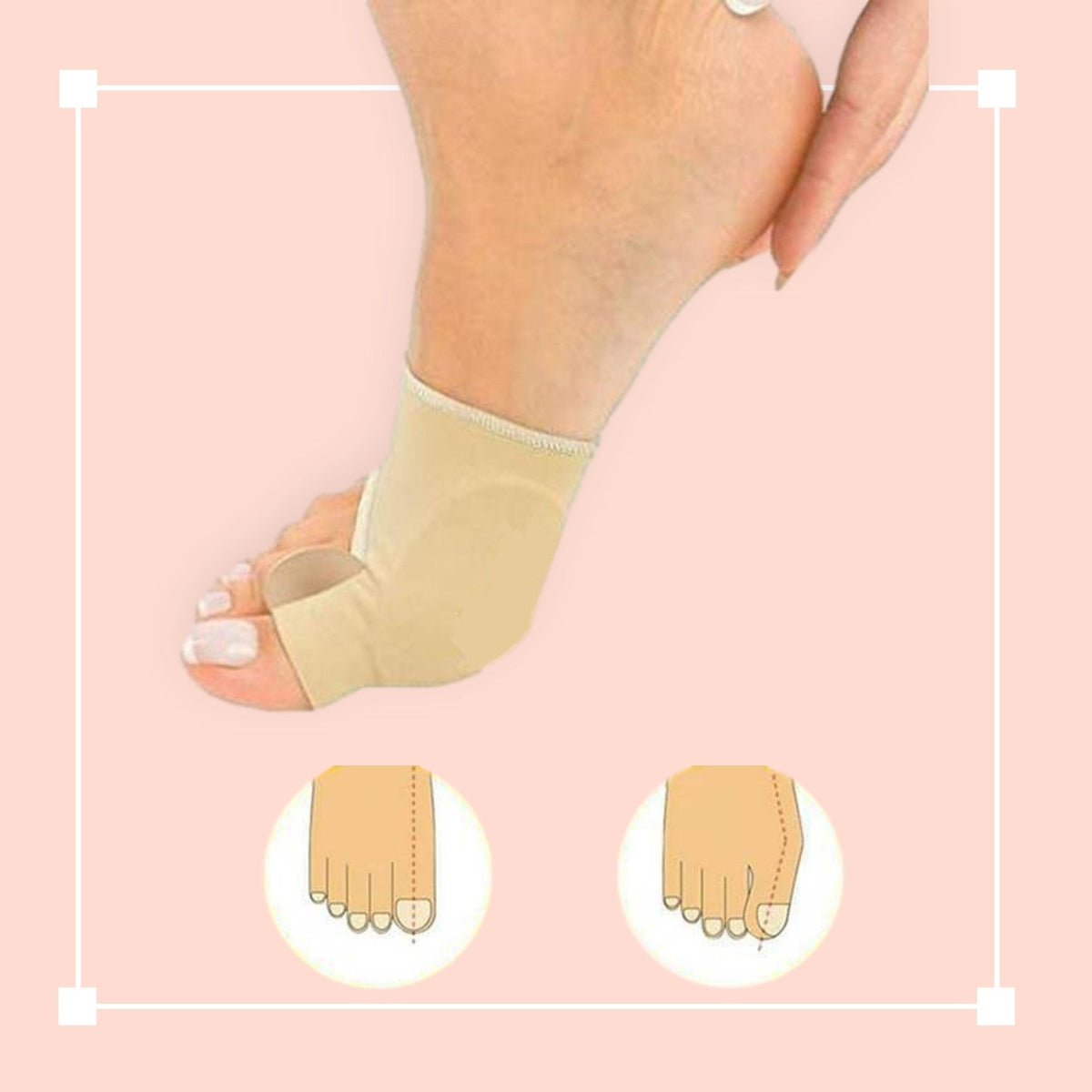 Teenspreidersleeve voor Hallux Valgus - Siliconen Teencorrector - Zachte Gelvoering - Eelt & Druk Preventie