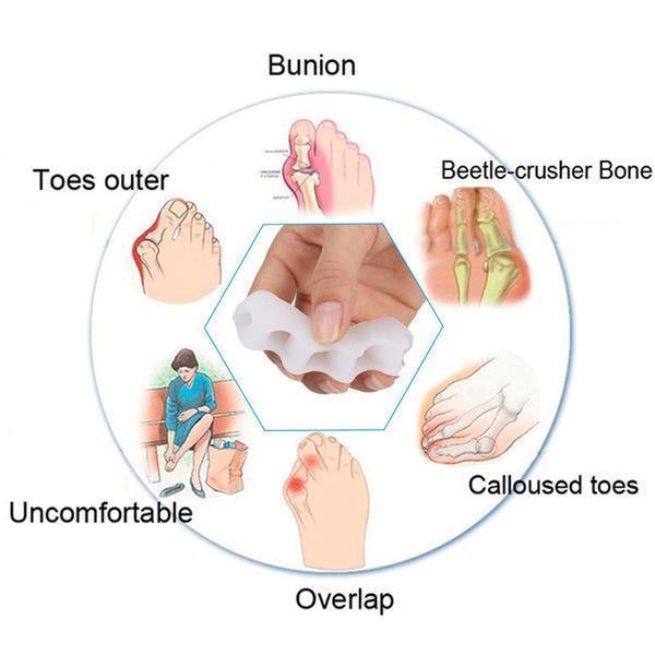 Orthopedische Teencorrector Siliconen Teenspreider Hallux Valgus Bunion Correctie voor Voetrevalidatie