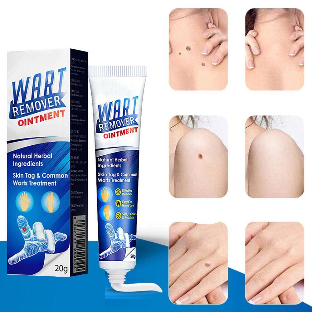 Huidverzorgende Gel tegen Wratten en Huiduitstulpingen 20ml met Plantaardig Extract voor Zachte Huid